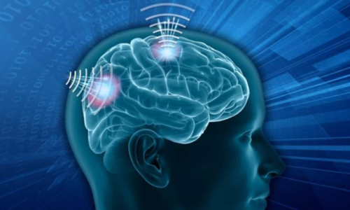 Wireless Brain Sensors Market