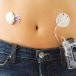 Artificial Pancreas Device Systems Market